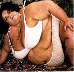 Click image for larger version

Name:	obese-fat-woman.jpg
Views:	35
Size:	31.4 KB
ID:	104863